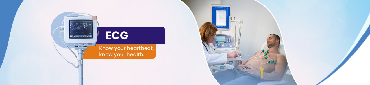 ECG